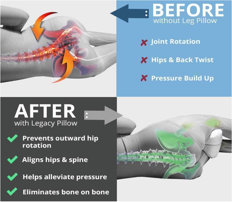 Sleep Package - Ergonomic Knee Pillow + Sleep Earplugs (inc 4x replaceable tips)
